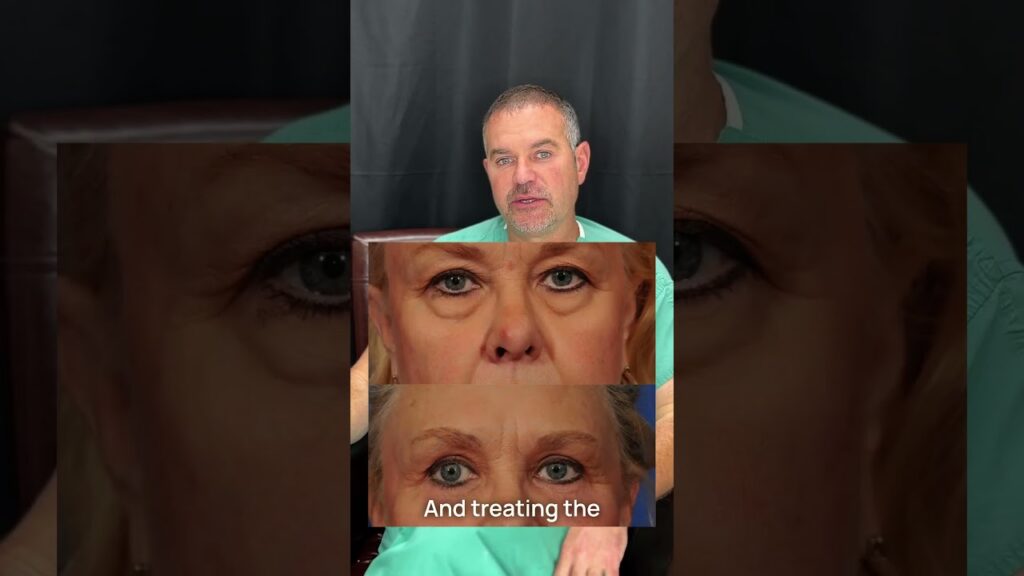 Say Goodbye to Tired Eyes: Understanding Upper and Lower Eyelid Surgery